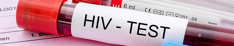 Анализ на ВИЧ в Брянске